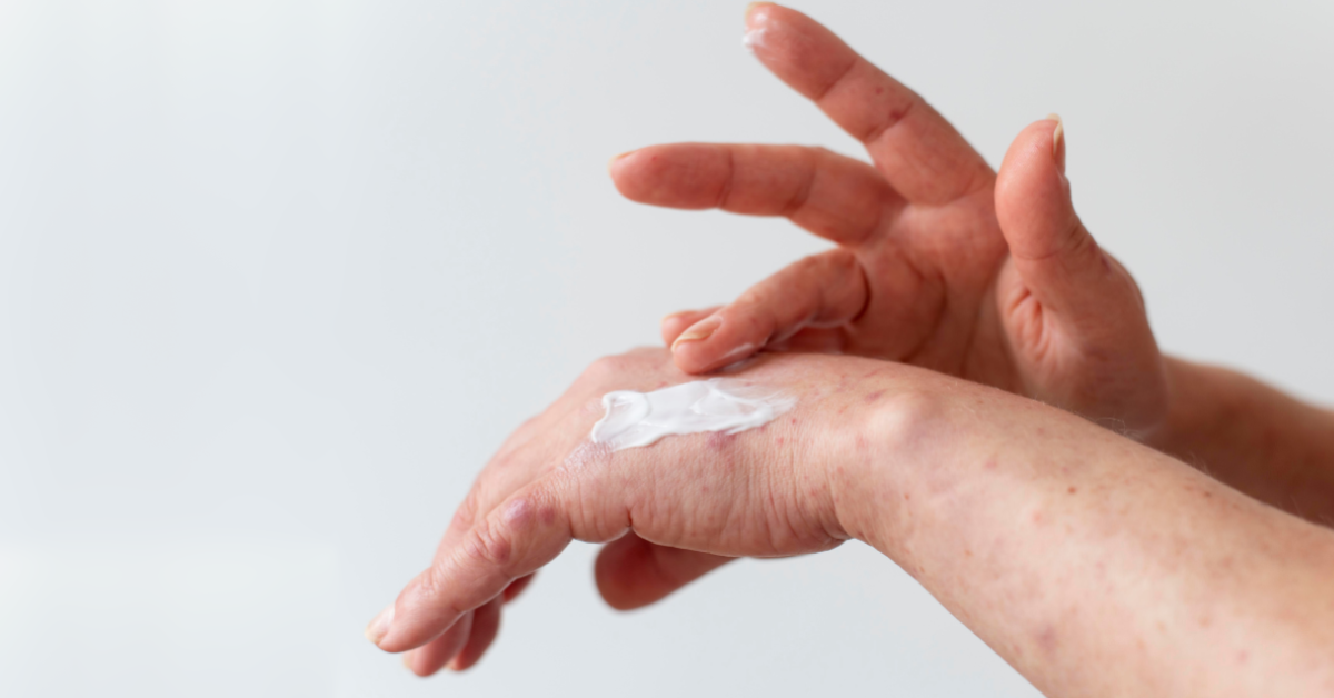 Eczema is not just a skin condition...