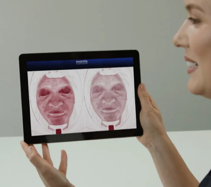 Eventis the cutting edge skin analysis machine